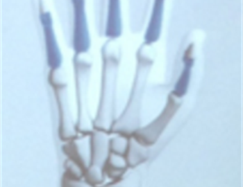 patología de la mano